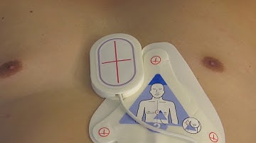 R Series Plus: Brief Overview - v14