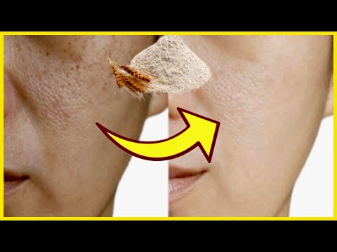 Video: Kako odstraniti madeže iz kože na obrazu vašega psa