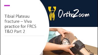 Tibial Plateau Part 2 - Viva practoce for FRCS T&O screenshot 5