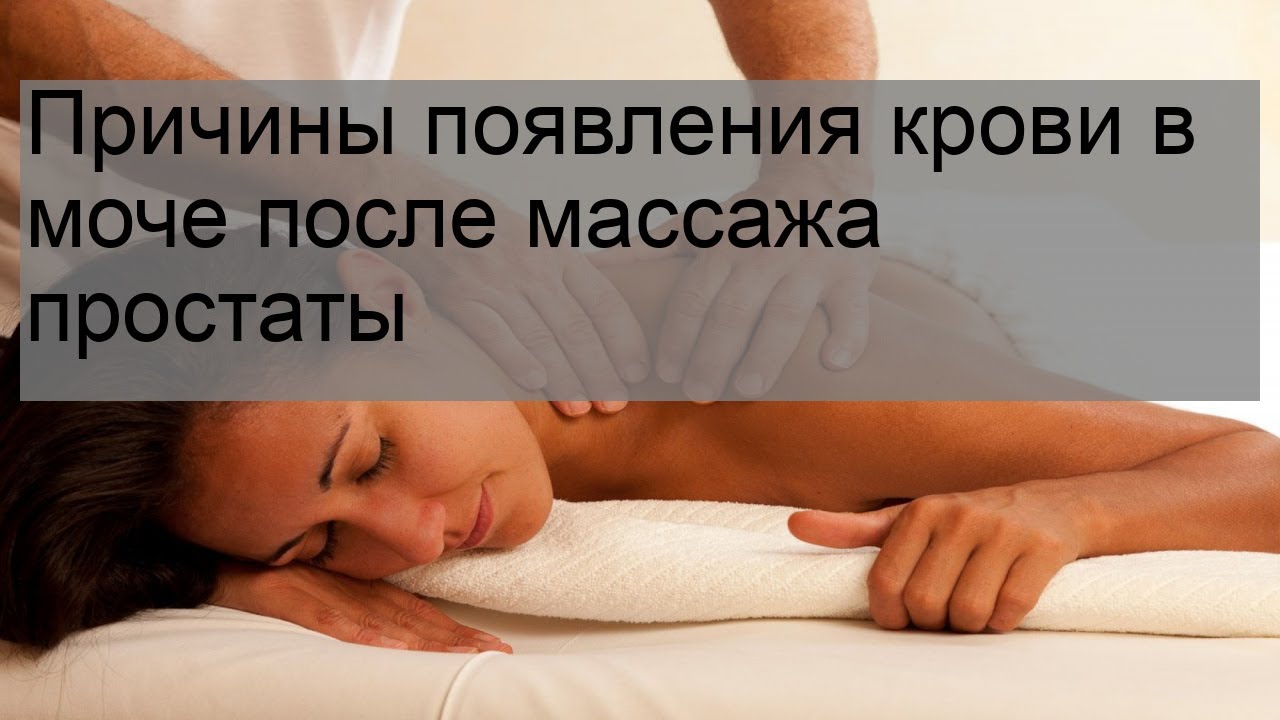 Причины появления крови в моче после массажа простаты