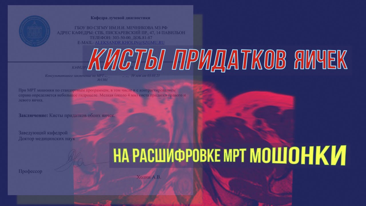 Кисты придатков яичка мрт. Киста яичка у мужчин фото. Мрт мошонки с контрастированием.