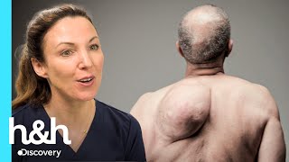 Paciente não olha para as próprias costas há 10 anos | Dra. Emma: Uma Questão de Pele | H&amp;H Brasil