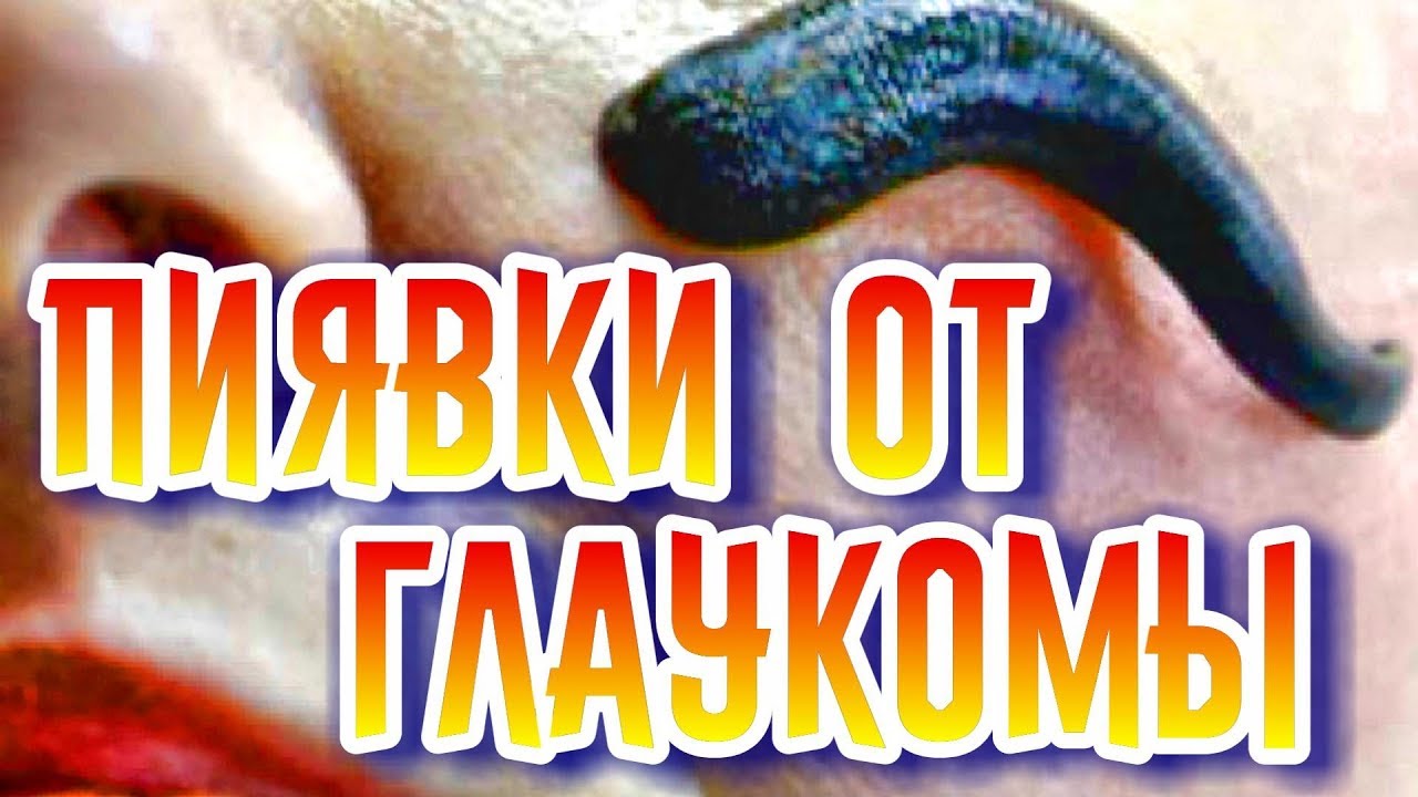 Как вылечить глаукому и мушки Восстановить зрение народными способами ...