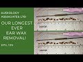 OUR LONGEST EAR WAX REMOVAL YET! - EP 109