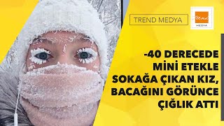 -40 derecede mini etekle sokağa çıkan genç kız, eve geldiğinde bacağını görünce çığlık attı Resimi