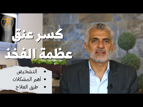 فيديو: 4 طرق لكسر الورك