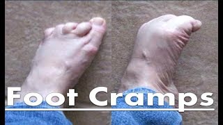 Foot Cramps at Night  The Home Treatment Guide!