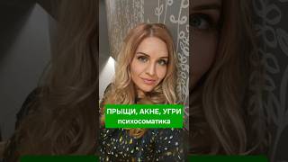 ПРЫЩИ АКНЕ УГРИ Конфликт обезображенности Психосоматика психосоматика прыщиналице кожа угри