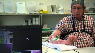 Brain-Computer interface used for rehabilitation after a stroke