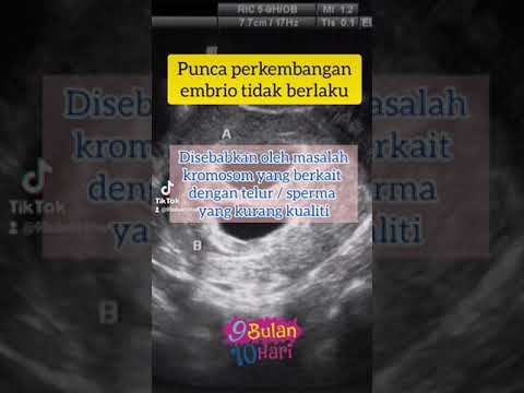 Video: Mengapa ujian usg dilakukan?