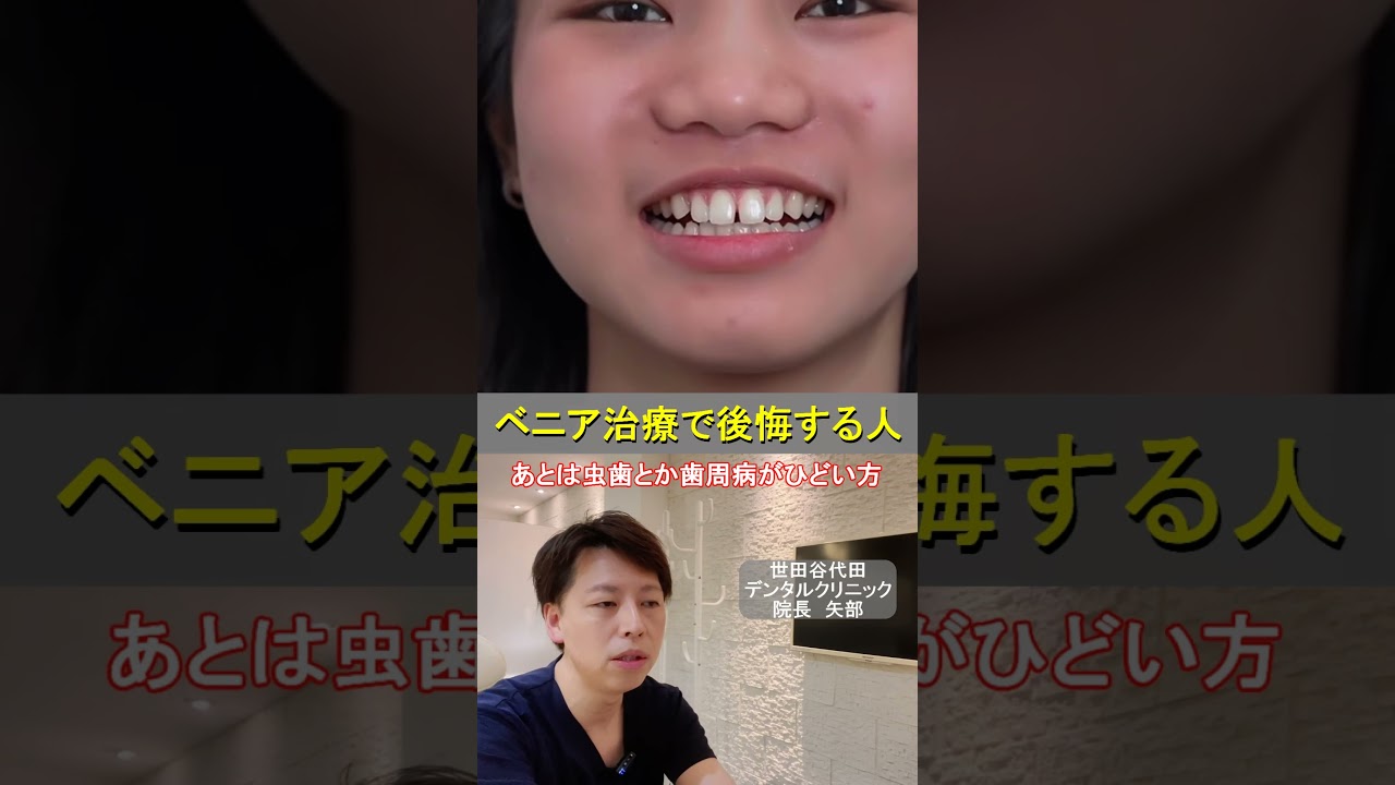 ベニア治療で後悔する人の特徴5選【治療前に必ず見て】★#すきっ歯 #マウスピース矯正 #ベニア治療 #美容歯科 #審美歯科 #セラミック治療 #費用