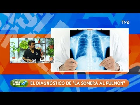 Video: Pulmonar Amante De La Sombra