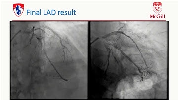 The Hybrid Approach - Stéphane Rinfret, MD
