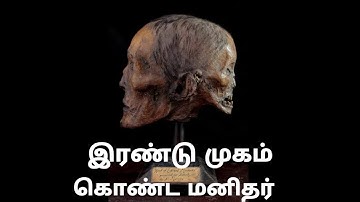 A Man With Two Face | Edward Mordake | Madhu Magazine