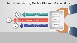 Periodontal Classification and Diseases with Professor Norrell