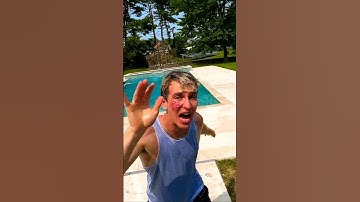 Stephen Sharer got STUNG 🤢 (GROSS)