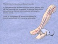 Doppler Auscultation of the Posterior Tibial Artery