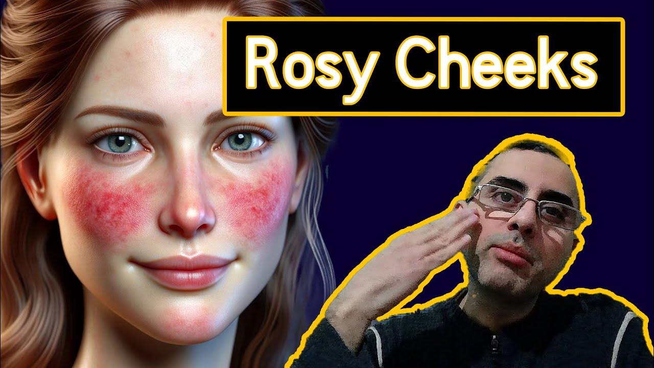 What Causes Red Cheeks
