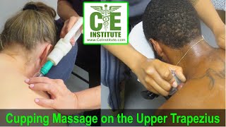 Orthopedic Cupping Massage with a Curved Cup on the Upper Trapezius Instructor Demonstration