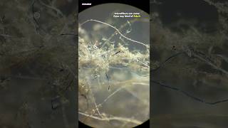 Dust From Air Purifier Under Microscope