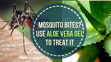 ¿El gel de aloe vera repele a los mosquitos?