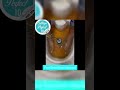 Ionic Foot Cleanse for wellness support. #kingstonjamaica #medicalspa #ionicfootcleanse