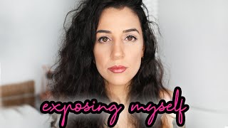 THE REALITY OF HAVING A NOSE JOB! 🐽 | depression & mood swings | Watch THIS before you have it done.