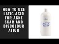 how to get rid of acne scars and discolouration with lactic acid.