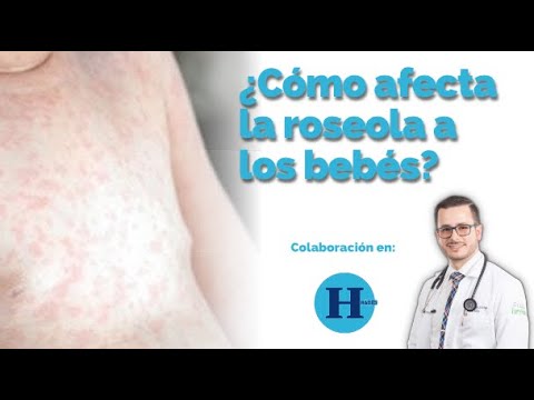 Video: ¿Necesito ir al médico por la roséola?