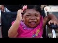 Trapped in a Baby&#39;s Body: 24 Years Old Woman Looks Like a Toddler! ~ Body Bizarre! Part 3