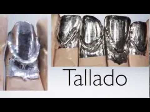 Platinum veneers YouTube Platinum veneers YouTube