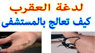 كيفية علاج لدغة العقرب