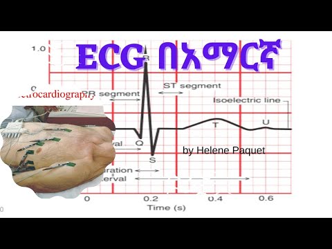 Electrocardiography (ECG)   #ECGን በአማርኛ (Part 5)