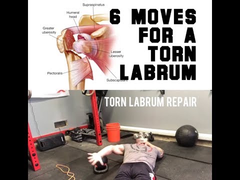 6 Moves for a Torn Shoulder Labrum | SmashweRx | Trevor Bachmeyer