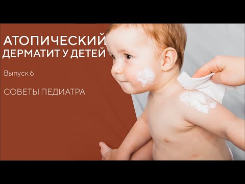 АТОПИЧЕСКИЙ ДЕРМАТИТ У ДЕТЕЙ | ПРИЧИНЫ И ЛЕЧЕНИЕ