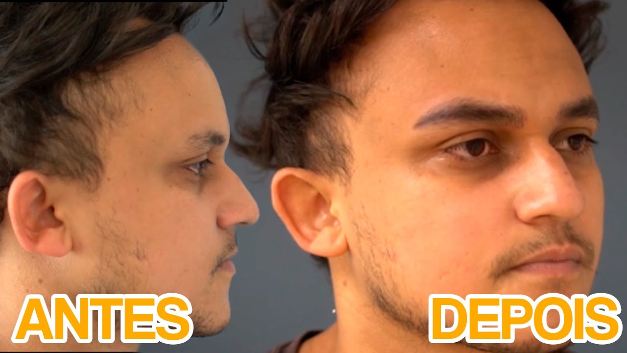 Micropigmentação de sobrancelhas masculina