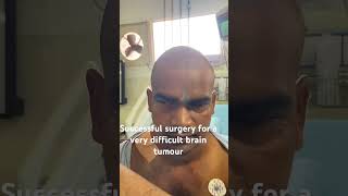 Treatment of Brain Tumor | Brain operation | Neurosurgeon in Meerut