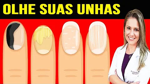 Quando as unhas estão com riscos?