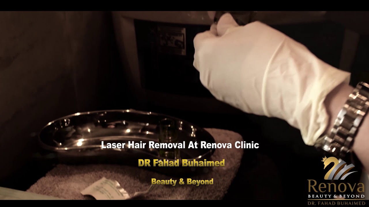 Laser For Hair Removal In Renova Clinic YouTube