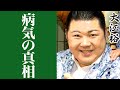 北島三郎の弟子・大江裕の生い立ちや現在に一同驚愕...!『北島兄弟』で人気を博した演歌歌手の病気の真相がヤバすぎる...