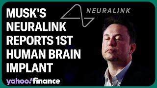 Elon Musk says Neuralink's first human brain implant was 'successful'