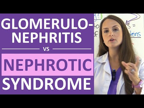 Nephrotic Syndrome Vs Glomerulonephritis | Nephritic Vs Nephrotic Syndrome Nursing NCLEX