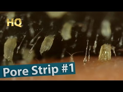 #1 Pore Strip Close up - Blackheads Removal