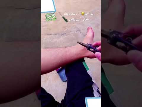 علاج شوكه بالرجل