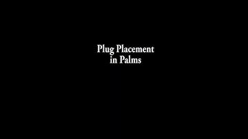 Injecting Palms, Part 7 - Inserting Plugs