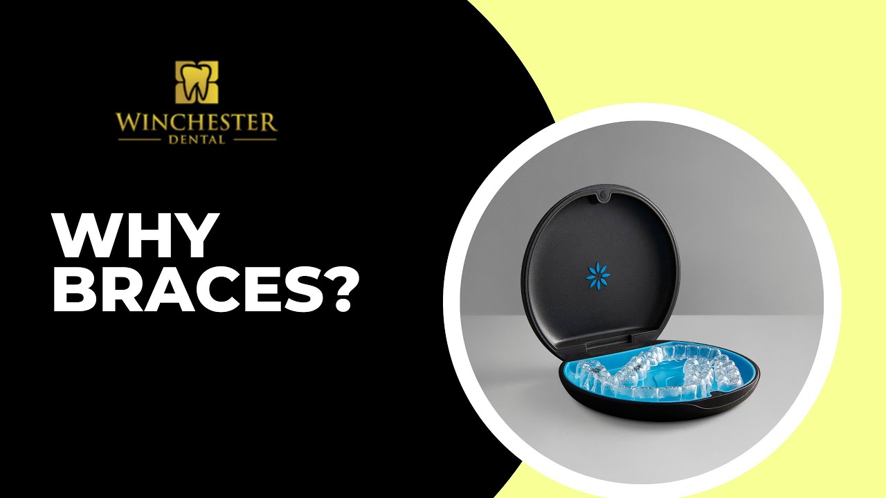 Why dental braces help | WINCHESTER DENTAL | Whitby Ontario