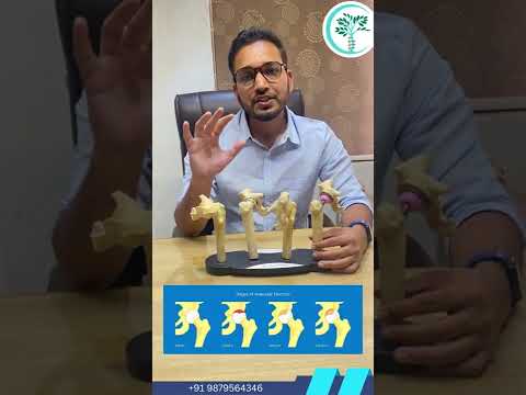 Total Hip Replacement, Avascular Necrosis Hip Surgery, Hip Pain Treatment in Adajan, Vesu, Surat