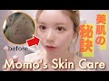 繰り返すニキビ肌を改善した最近のスキンケア！