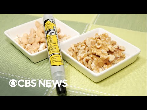 वीडियो: खाद्य एलर्जी के लिए परीक्षण कैसे करें: 11 कदम (चित्रों के साथ)