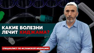 Какие болезни лечит хиджама? | Пророческая медицина